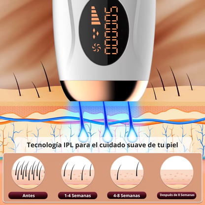 Depiladora Láser IPL Profesional